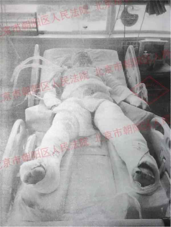 奥仁格管道安全警示：高压垂钓事故全解析